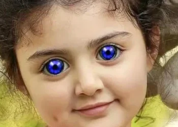 Ent.News: God Is Great: See 25 Photos of Little Kids That Were Born with Unusual Eyes