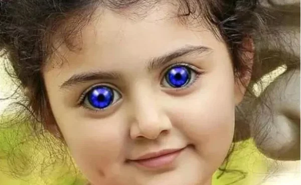 Ent.News: God Is Great: See 25 Photos of Little Kids That Were Born with Unusual Eyes